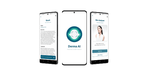 DermaScan project preview